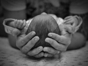 Hydrocephalus-childhood illnesses