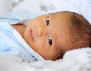 newborn jaundice