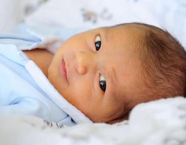 newborn jaundice