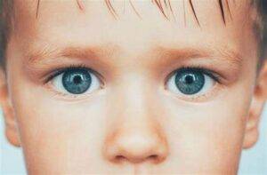 Strabismus-Unlock insights into uveitis with our informative guide. Explore causes, symptoms, and effective management strategies for this eye condition-uveitis
