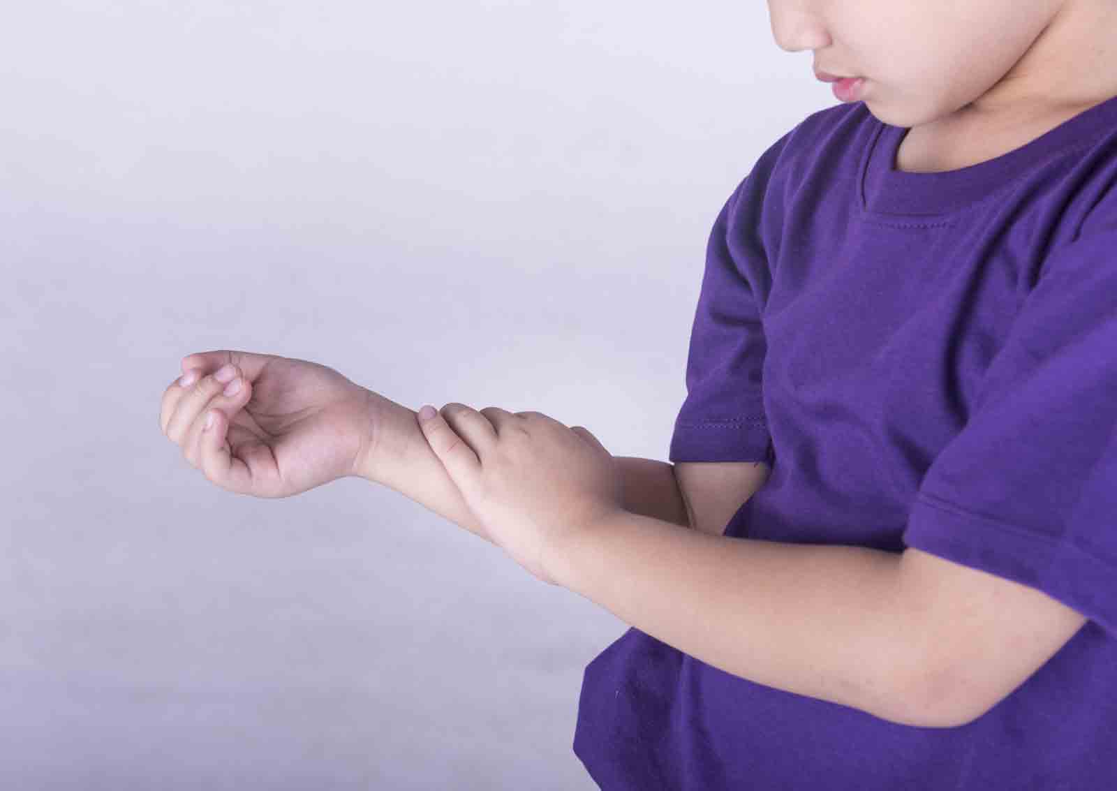 child with Juvenile Arthritis