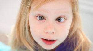 Strabismus-Xerophthalmia