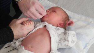 Circumcision newborn