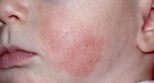 newborn-baby-is-red