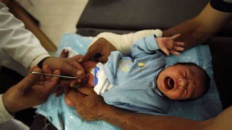 baby-Circumcision-infant-circumcision-newborn-Circumcision