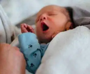 Why Is My Newborn Baby Red: A Complete Pediatrician Guide for Baby's Comfort 1 newborn-baby-is-red