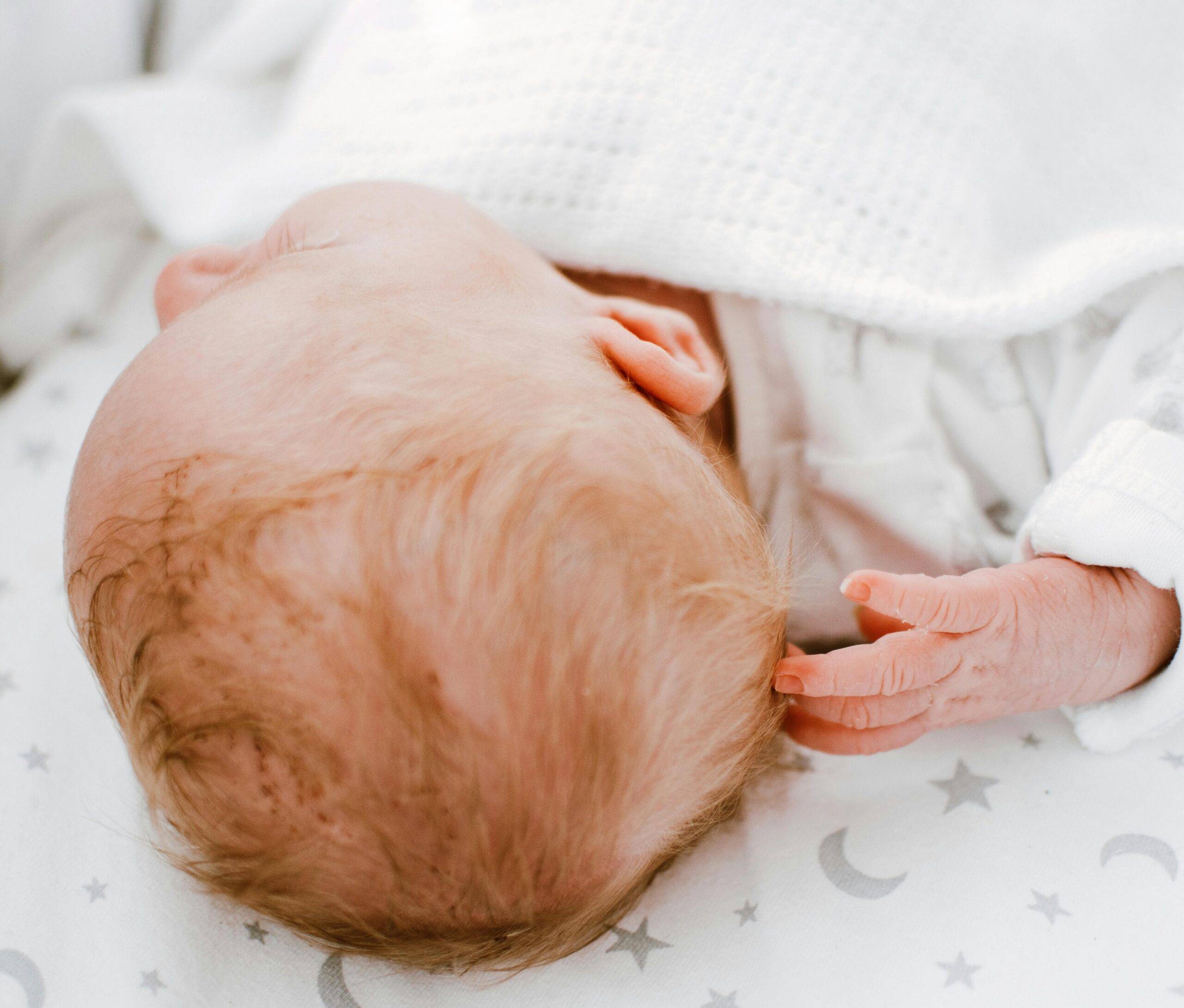 Why Does Newborn Baby Hair Fall Out? 5 Common Causes Explained
