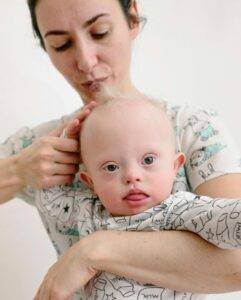 Newborn Hair Loss: Is It Normal and When Does Hair Grow Back? 5 newborn baby hair fall off