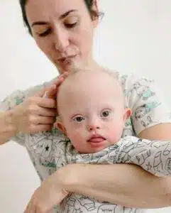 newborn baby hair fall off