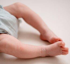 newborn baby skin red