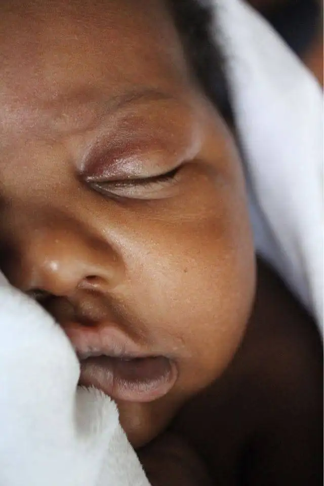 stop breastfeeding