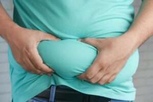 obesity3 300x200 1